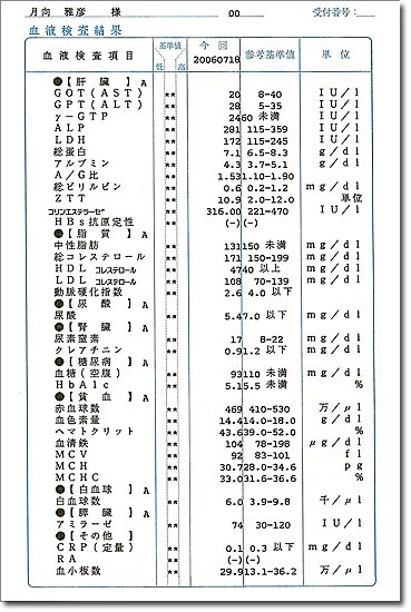 長い待ち時間のあと